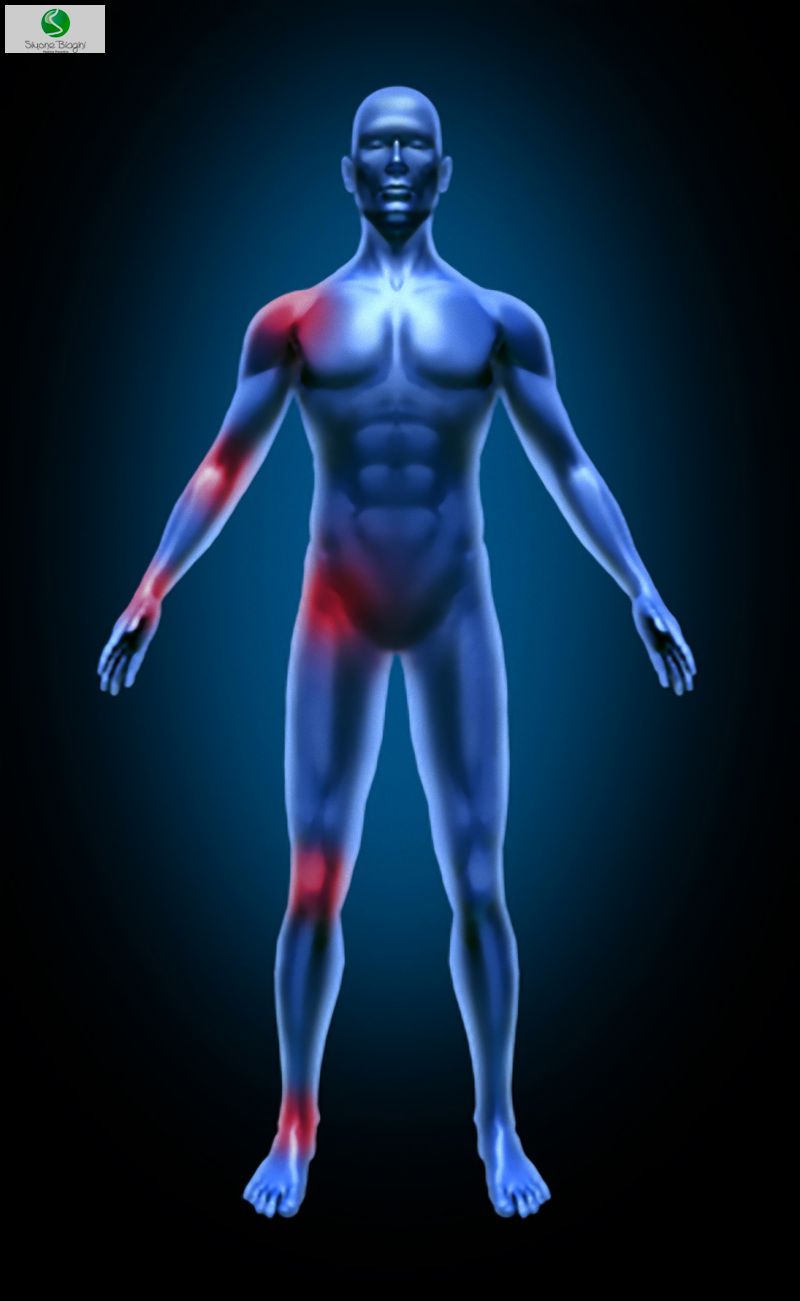 Acupuntura ajuda no tratamento da fibromialgia