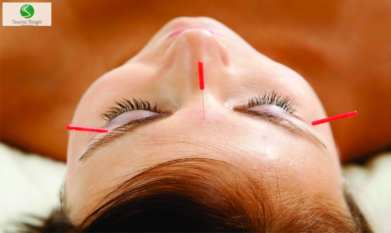 Acupuntura e moxabustão no tratamento de transtornos psiquiátrico