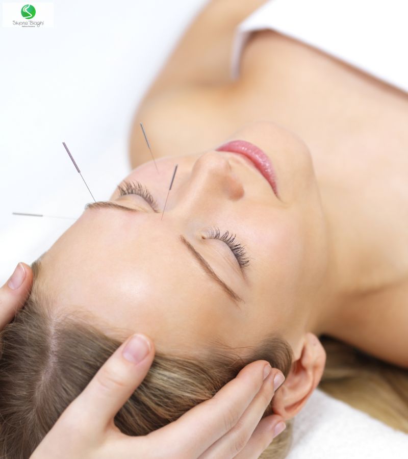 Acupuntura no tratamento da paralisia facial