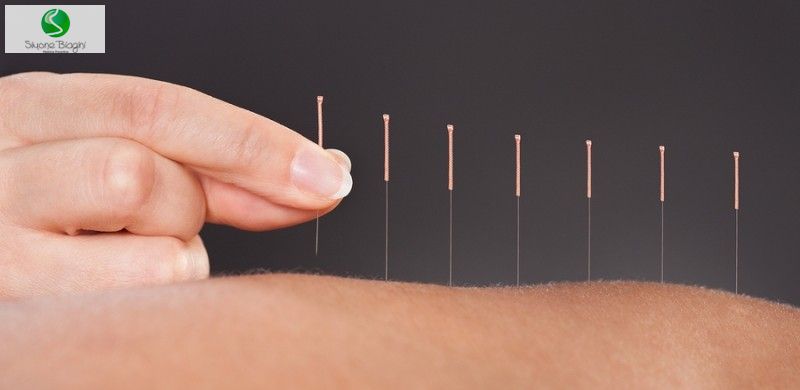 Tratando pressão alta com a acupuntura