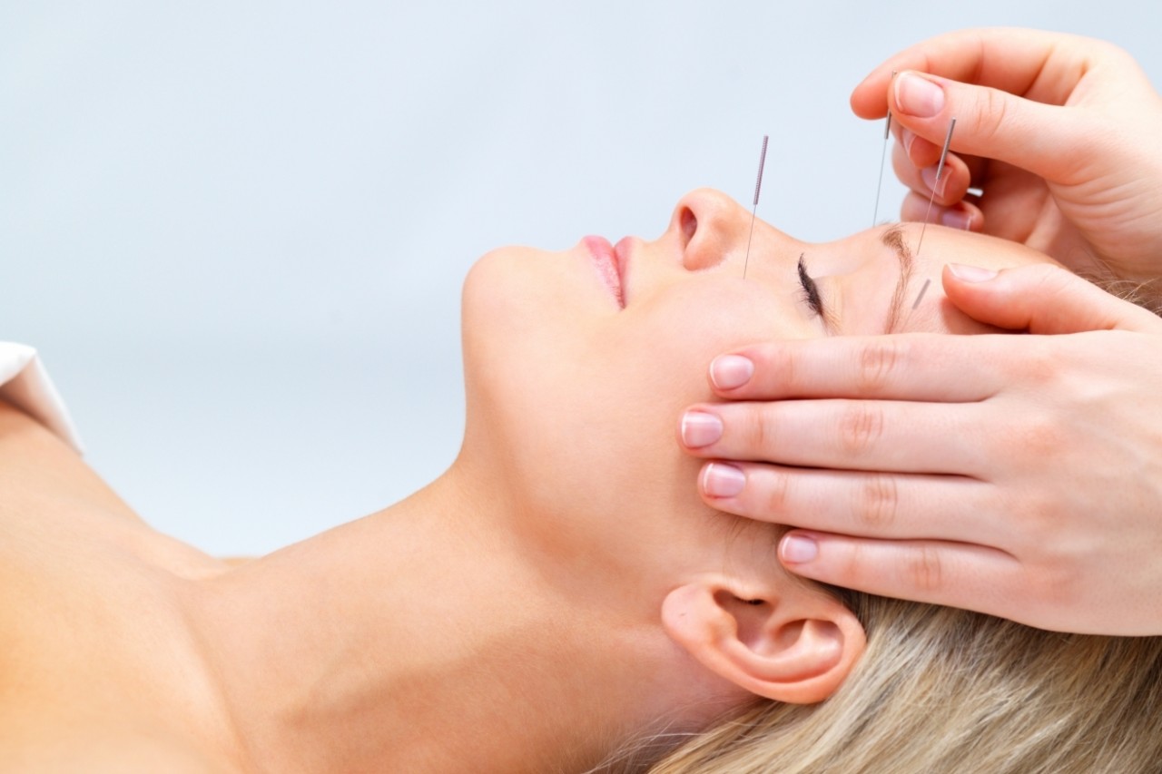 Acupuntura: Uma técnica milenar